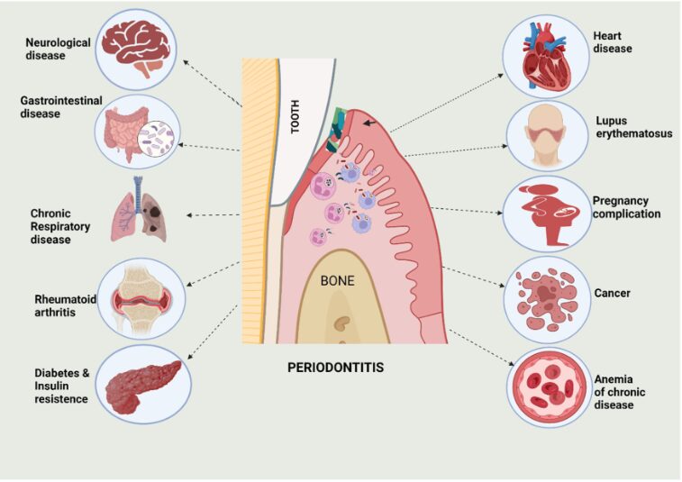 Comprehensive Insights into Periodontal Health and Its Systemic Connections