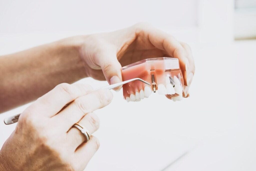 Options for Missing Teeth: Finding the Right Fit for Your Smile
