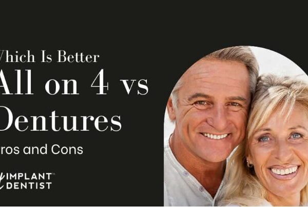 The Advancements and Benefits of All-on-Four Dental Implants