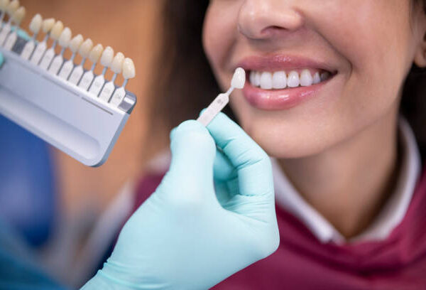 Understanding the Different Types of Dental Crowns: Which Is Right for You?
