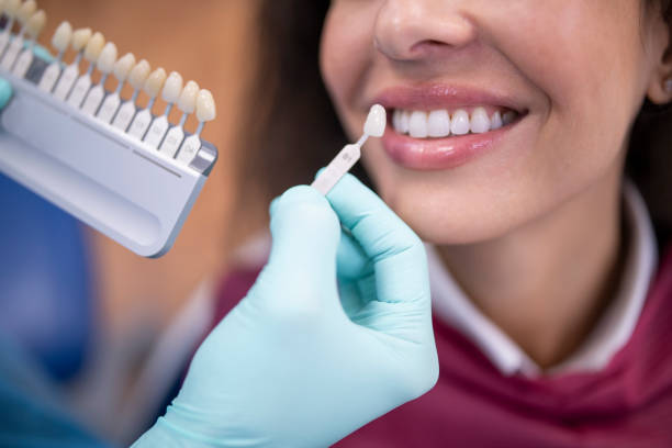 Understanding the Different Types of Dental Crowns: Which Is Right for You?