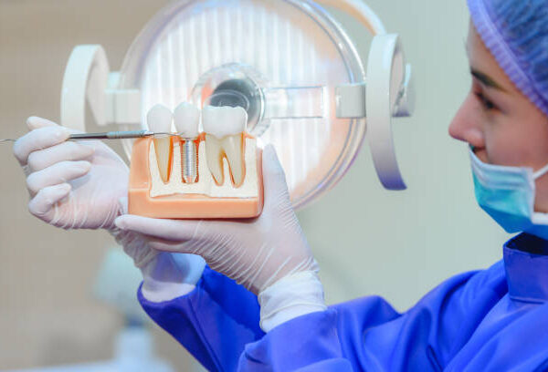 Dental Implants: Revolutionizing Oral Health and Restoring Smiles