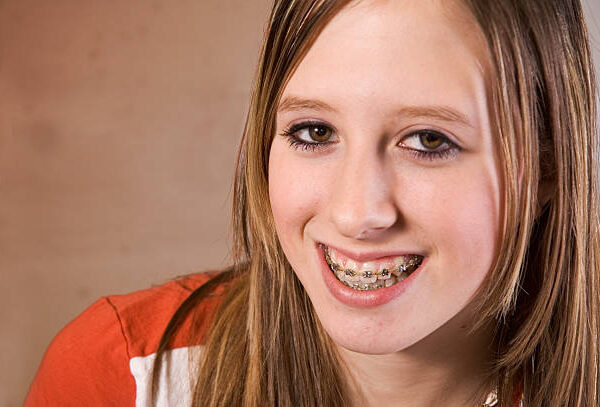 Exploring Orthodontic Brace Options for Perfectly Straight Teeth