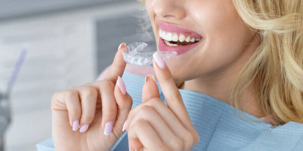 The Role of Teeth Aligners in Orthodontic Treatment Plans