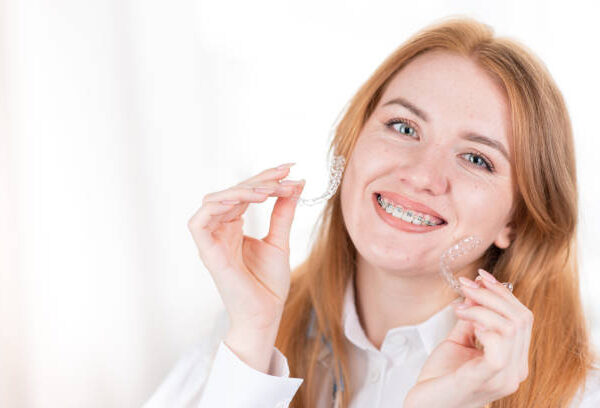 The Ultimate Guide to Teeth Braces Types: Which One is Right for You?