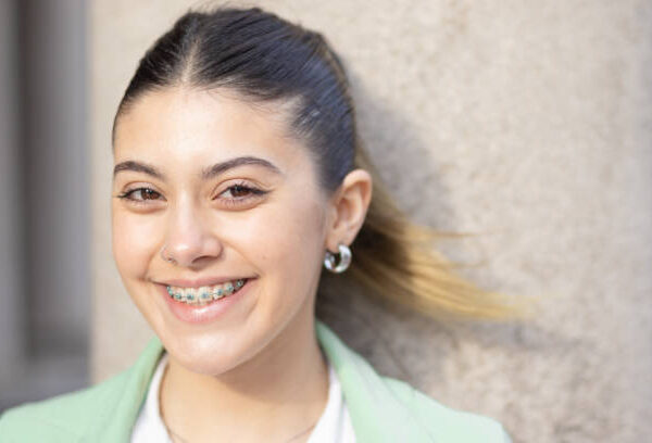 The Benefits of Dental Braces for Your Oral Health