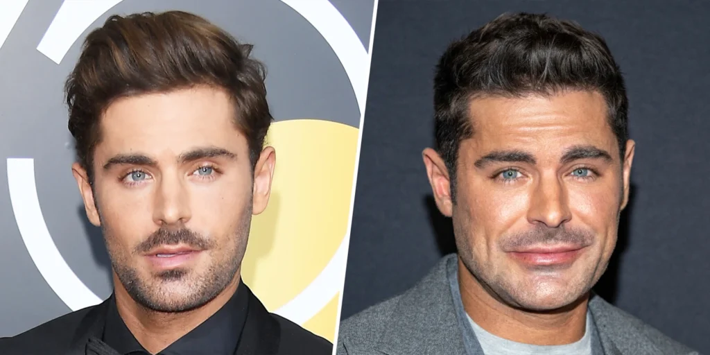 5 Surprising Facts About Zac Efron Jawn Transformation